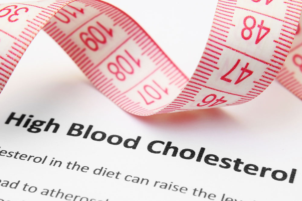 Symptoms, causes, and risks of high cholesterol